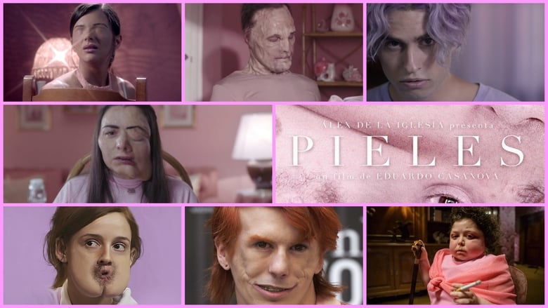 Skins – Pieles