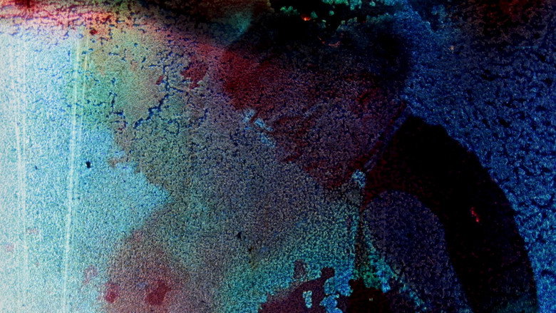 Imatge de Pigment-Dispersion Syndrome