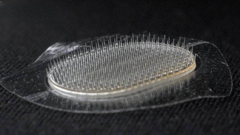 Dissolving Microneedles