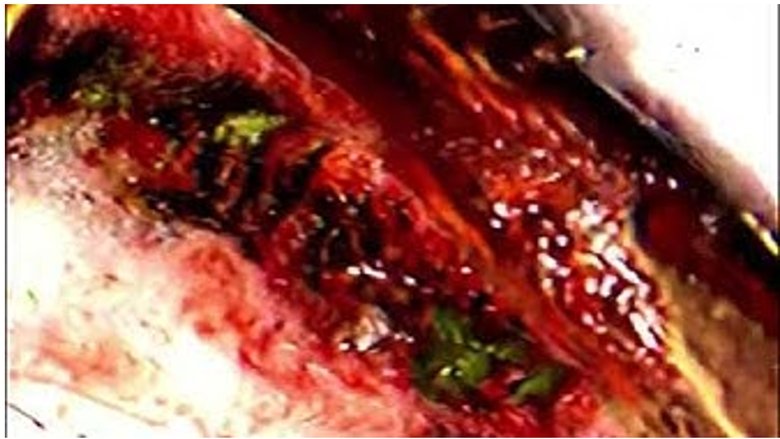 Still image for GREYLOCK season 1 episode 2: TAPE 002 - to the mountain Still image for GREYLOCK season 1 episode 2: TAPE 002 - to the mountain