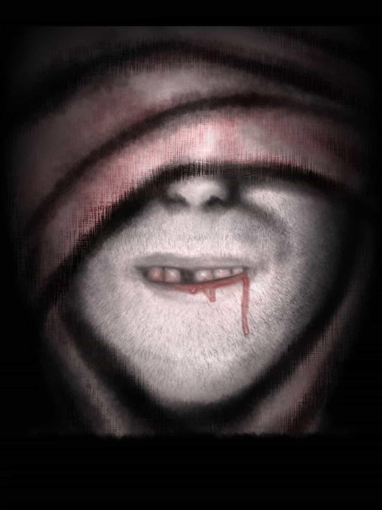Toothache