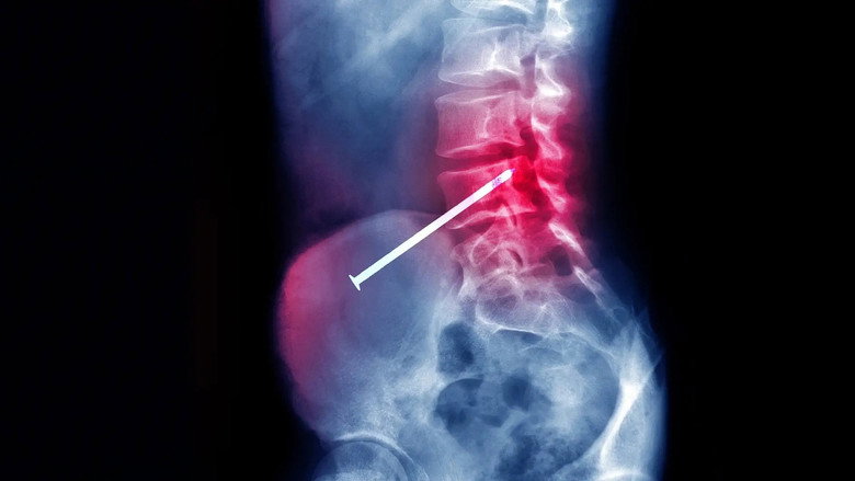 Body Invaders Photo 1