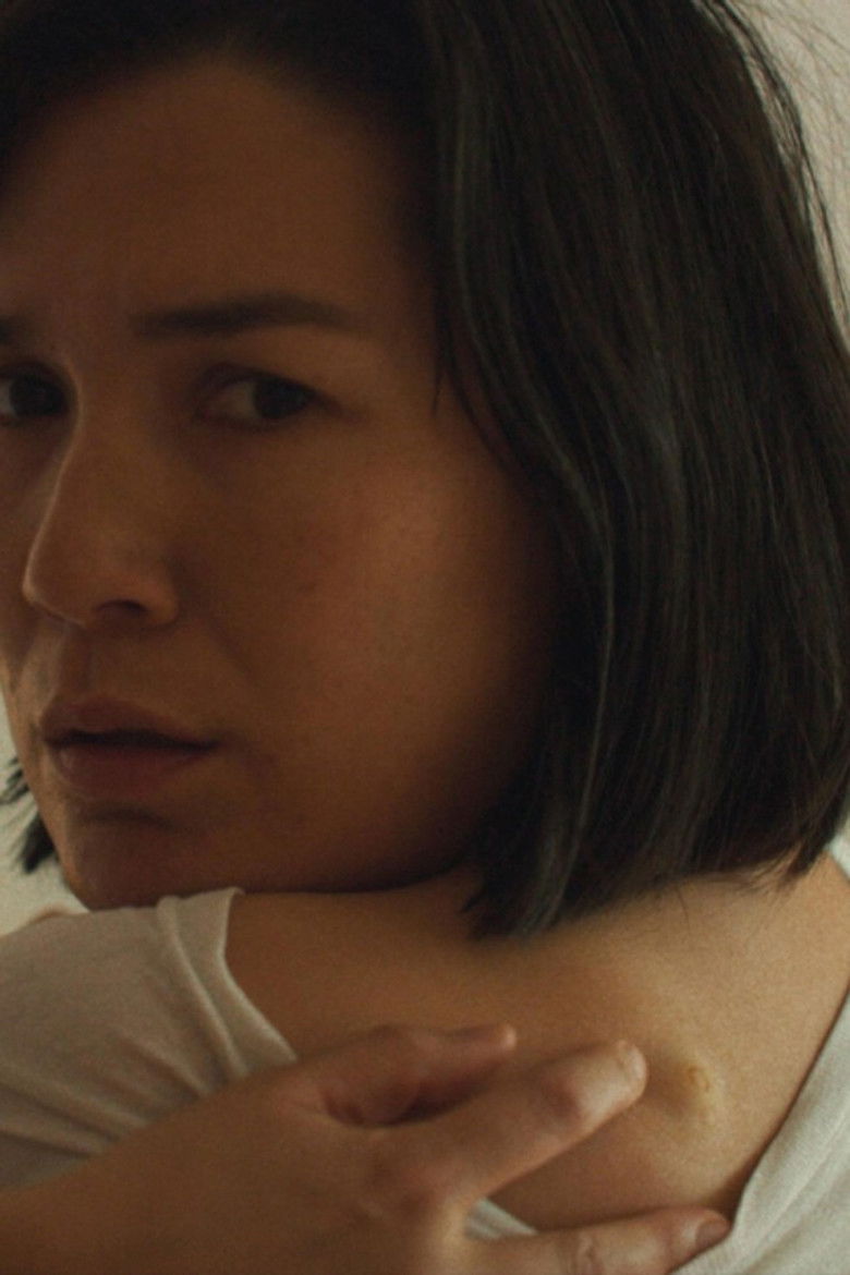 Imatge de The True Beauty of Being Bitten by a Tick