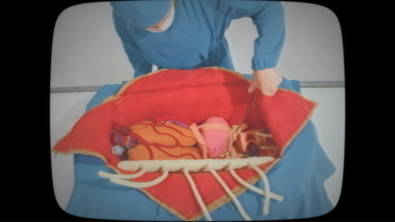 Imatge de I Dissected a Body and All I Found Was Yarn