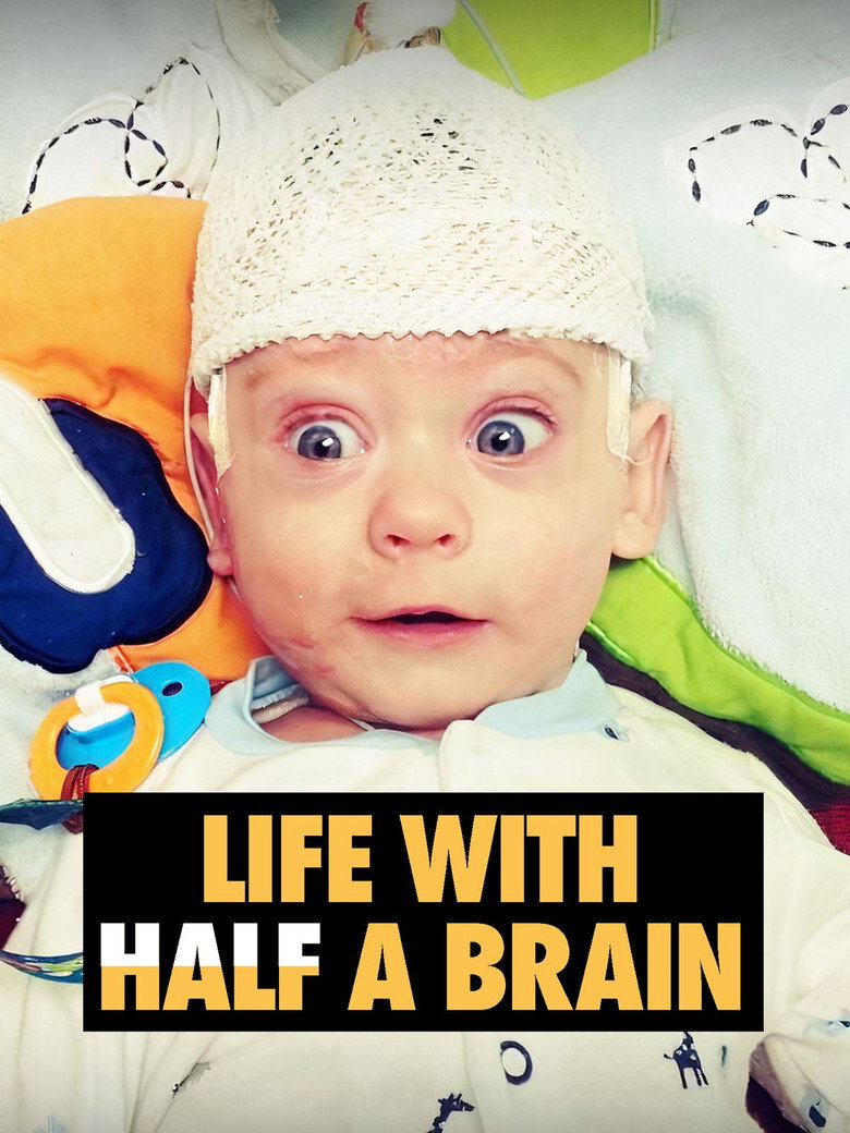 Life with Half a Brain background