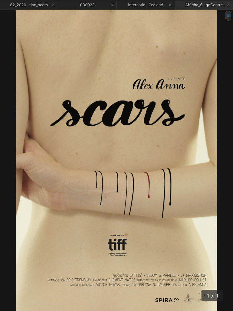 Imatge de Scars