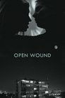 Open Wound