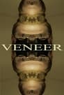 Veneer