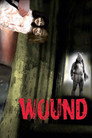 Wound