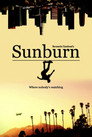 Sunburn
