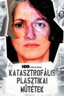 Katasztrofális plasztikai műtétek (HD). Katasztrofális Plasztikai Műtétek Teljes Film Magyarul (2006) Ingyen Online