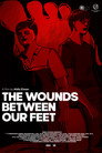 The Wounds Between Our Feet