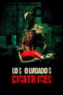 Los olvidados: Cicatrices