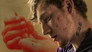 Fentanyl: Deadlier Than Heroin