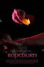 Ropeburn