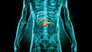Detecting Cancer Cases