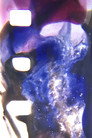 MEDULLACHROME TEST