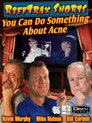 You Can Do Something About Acne You Can Do Something About Acne(1970)|オンラインで映画を視聴