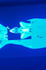 X-Ray Katx