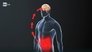 Xylella, the brain-gut link, and private astronauts