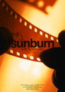 sunburn