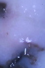 myxoInVitro00
