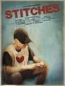 Stitches