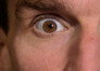 Eyeball