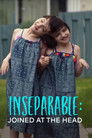 Inseparable: Ten Years Joined at the Head