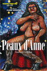 Peaux d’Anne