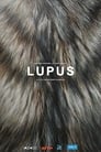 Lupus