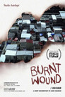 Burnt Wound