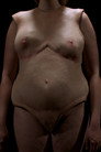 Vessel