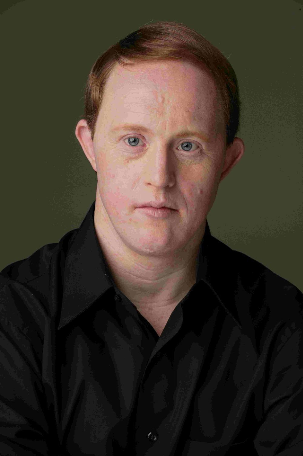 Chris Burke as Charles "Corky" Thatcher in Life Goes On