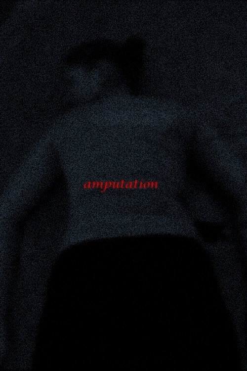 Amputation